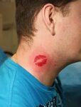 Red Kiss Lips Tattoo On Neck For Men Photo - 2 2017: Real Ph